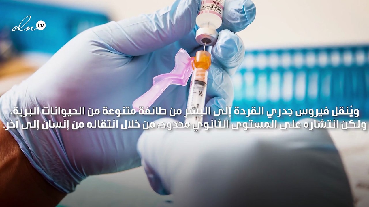 جدري القردة مرض نادر ولا علاج أو لقاح لمكافحته