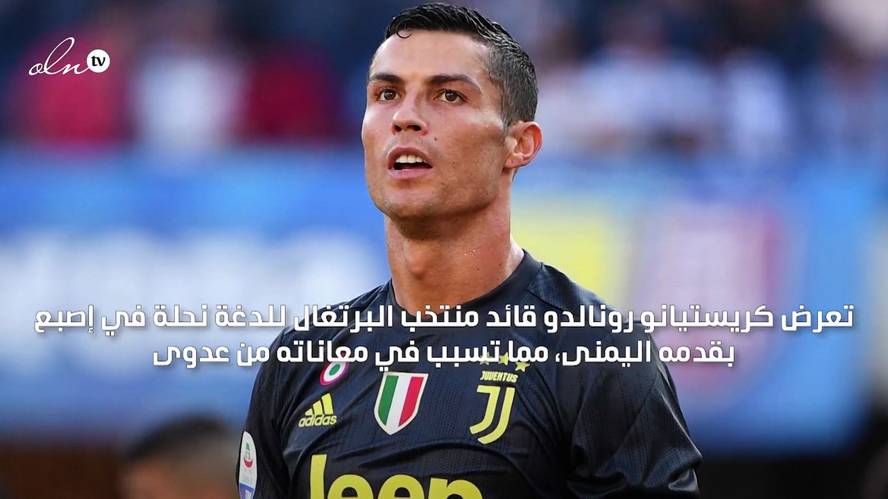 رونالدو يغيب عن مباراة منتخب البرتغال بسبب نحلة