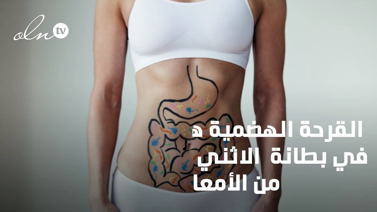 علاج قرحة المعدة