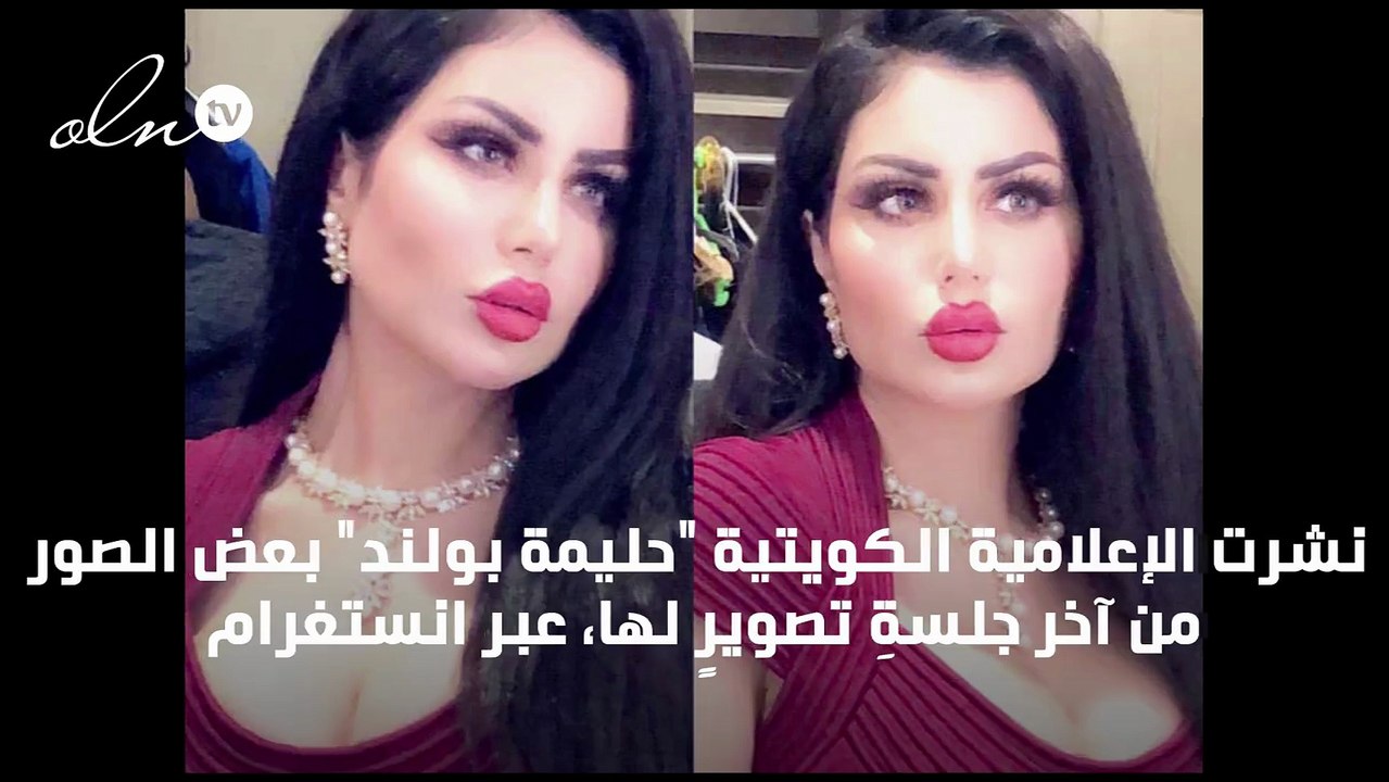 اضغط لمشاهدة الصور: حليمة بولند تظهر بإطلالة جديدة وشفاهٍ ممتلئة، والمتابعون يعلقون: لم نعرفها!