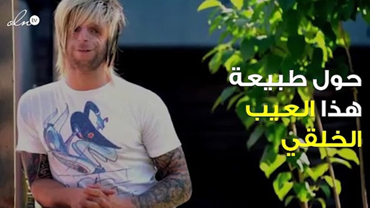 تخلى عنه والداه بعد 36 ساعة من ولادته فقط لأنه قبيح... حياته اليوم تخطت المتوقع!