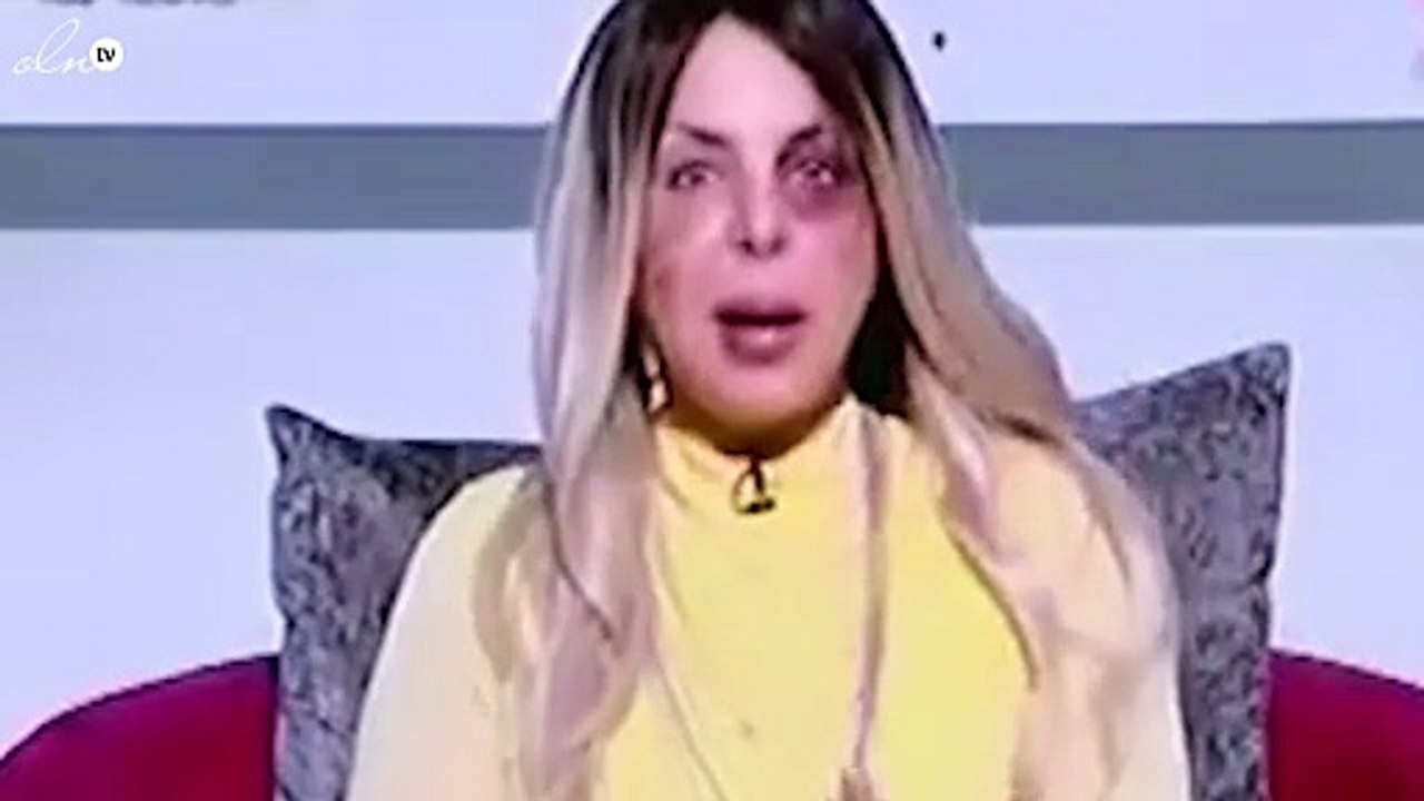ما السبب وراء ظهور هذه المذيعة مضروبة على الهواء؟