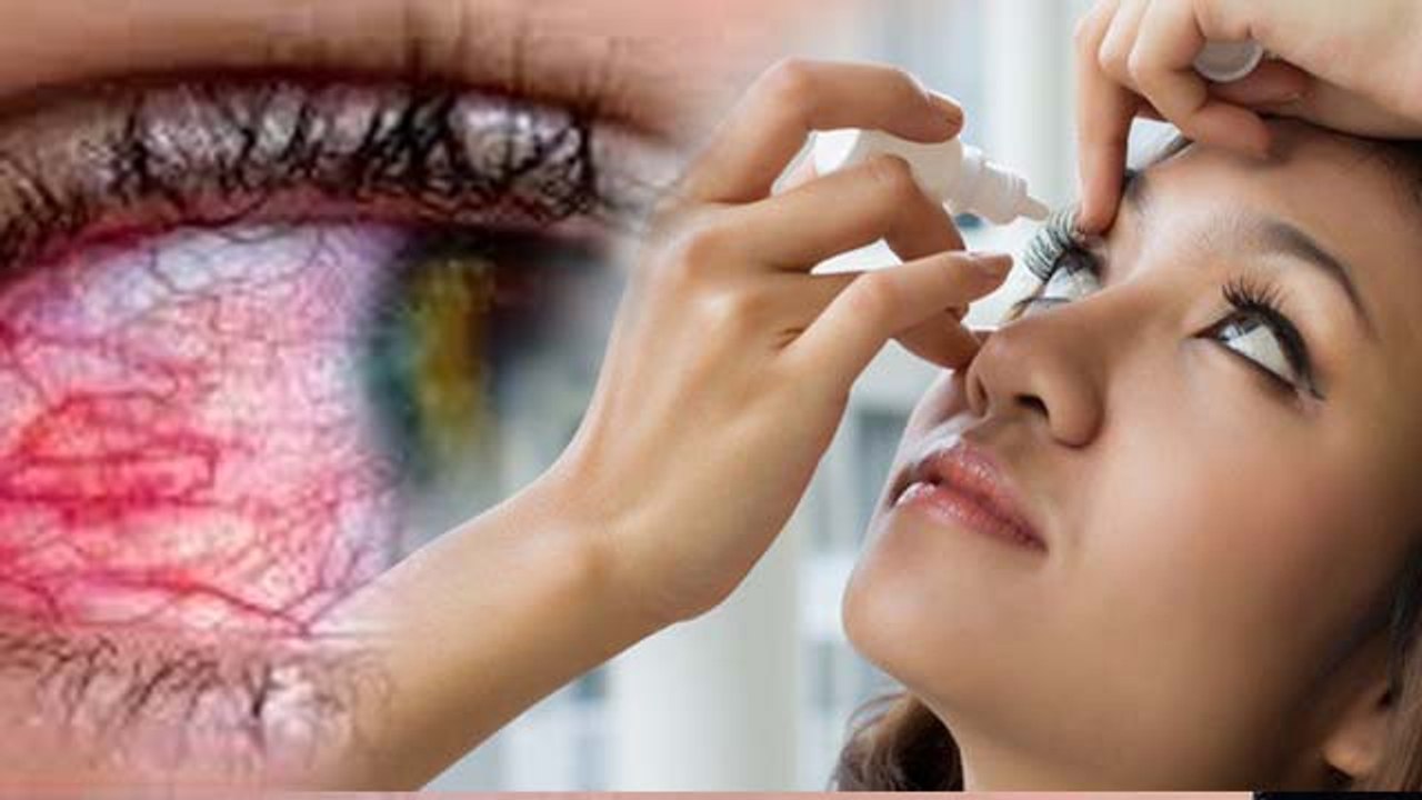आंख में दर्द क्यों होता है | Ankho Ki Naso Me Dard Kyu Hota Hai | Eye Pain Causes & Treatment