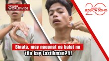 Binata, may nauunat na balat na tila kay Lastikman?! | Kapuso Mo, Jessica Soho