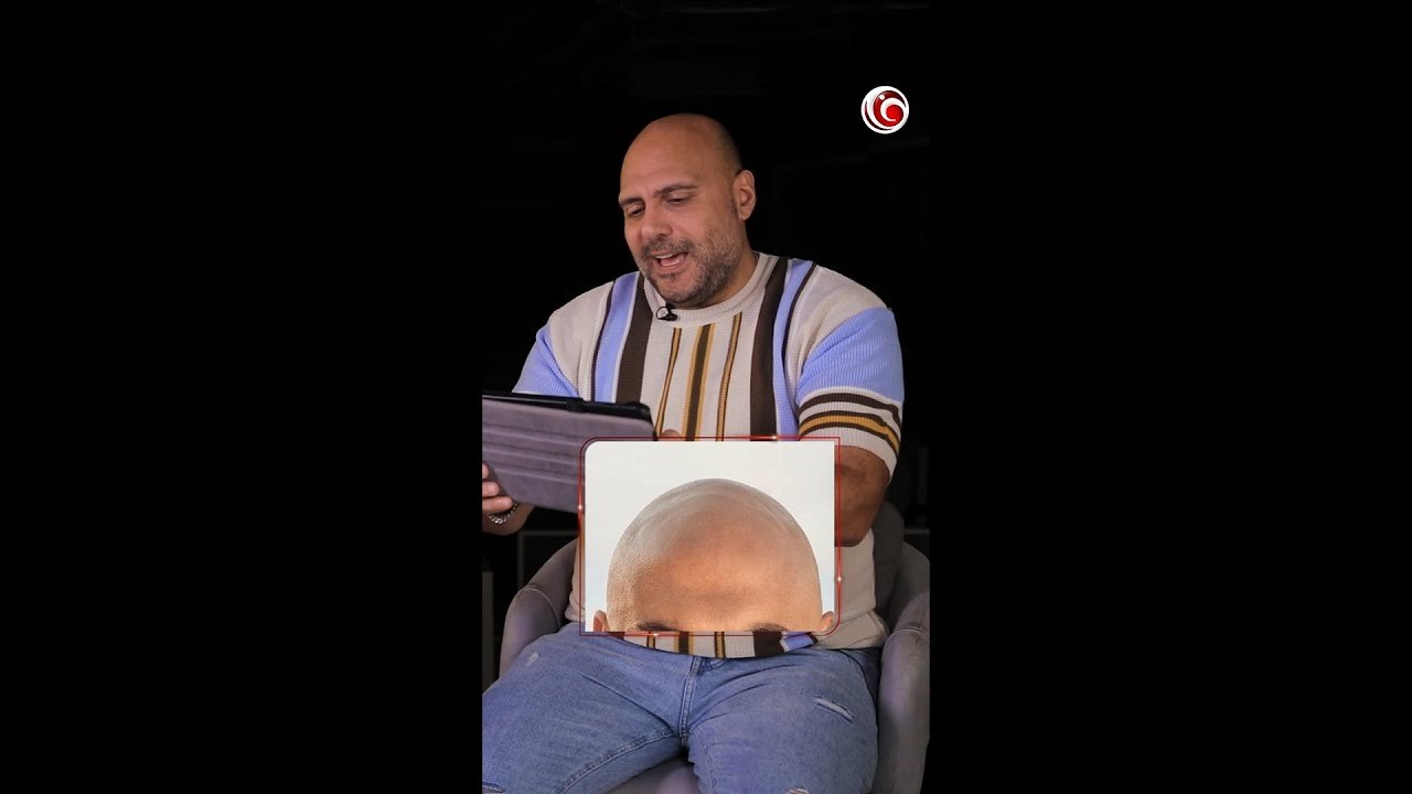 ساعد وليد فواز يتعرف على الفنان من صلعته 👩‍🦲