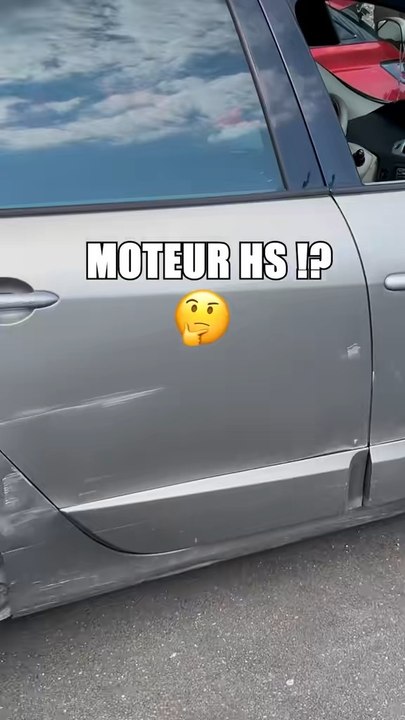😬😬