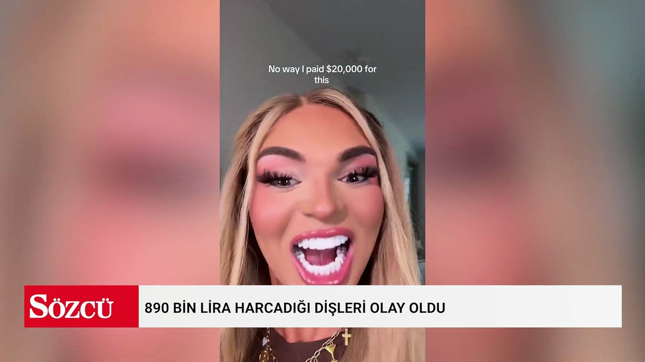 890 bin lira harcadığı dişleri olay oldu: Eleştiri yağmuruna tutuldu