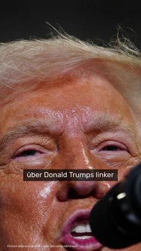 No Glomex Donald Trump gestürzt?: Rätselhafter Bluterguss im Gesicht - Weißes Haus schweigt zu Trump-Verletzung