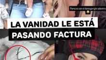 La vanidad le está pasando factura