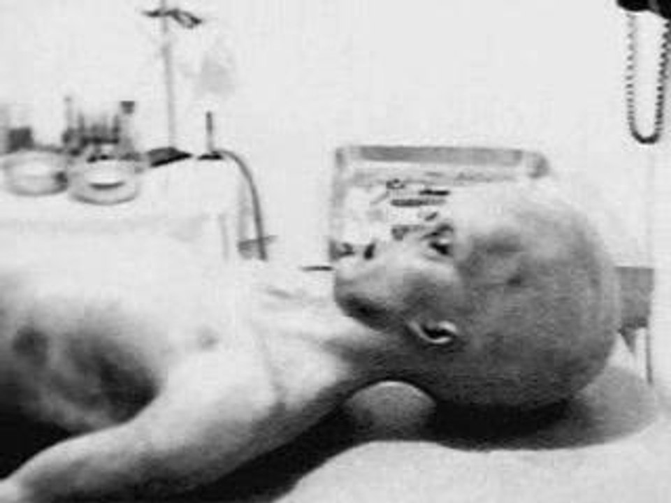 L'autopsie de Roswell