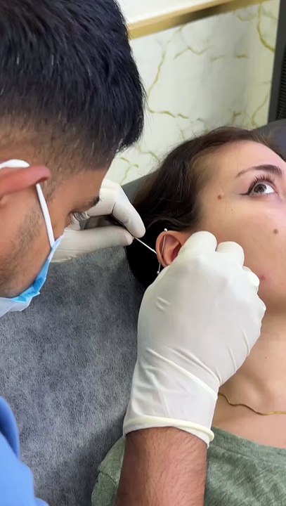 I Got a Daith Piercing — Here's What Actually Happensn #daithpiercing #conchpiercing #helixpiercing