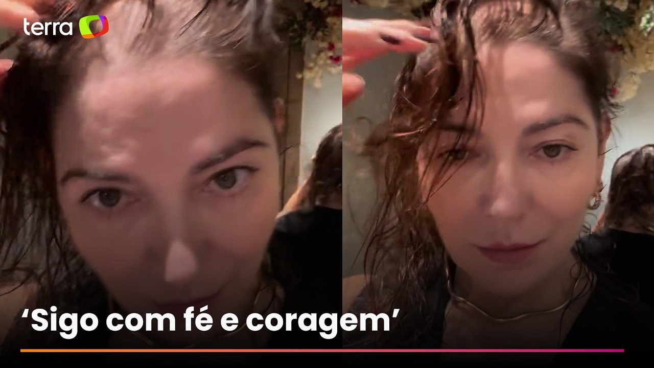 Mãe de Lucas Lucco mostra efeitos da alopecia e diz: 'Meu filho chorou'