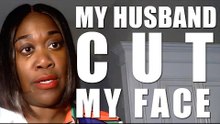 My Ex Husband Sliced My Face Open