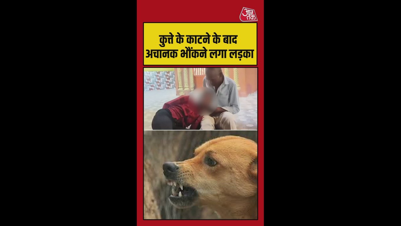 कुत्ते के काटने के बाद अचानक भौंकने लगा लड़का