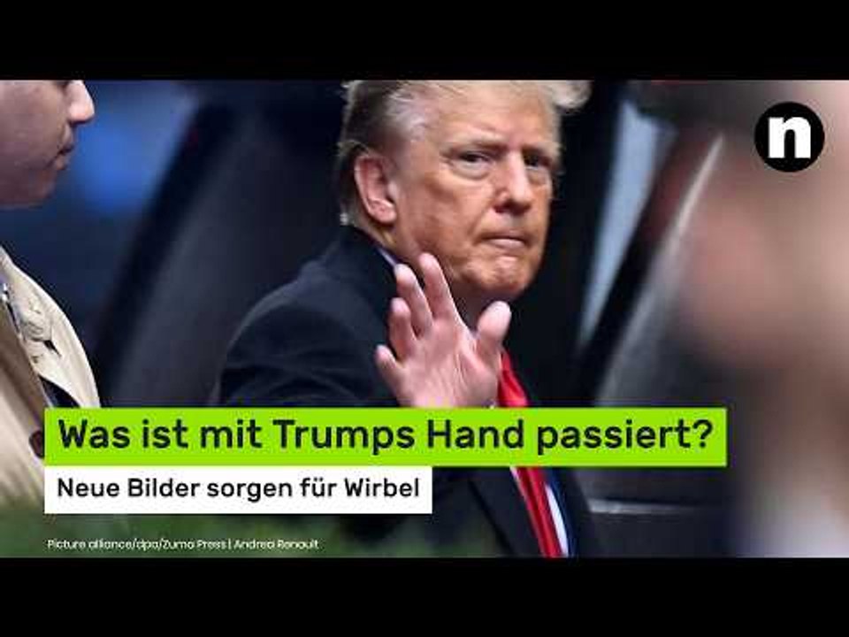 Donald Trump krank?: Neue Bilder sorgen für Wirbel - was ist mit Trumps Hand passiert?