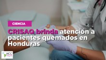 CRISAQ brinda atención a pacientes quemados en Honduras