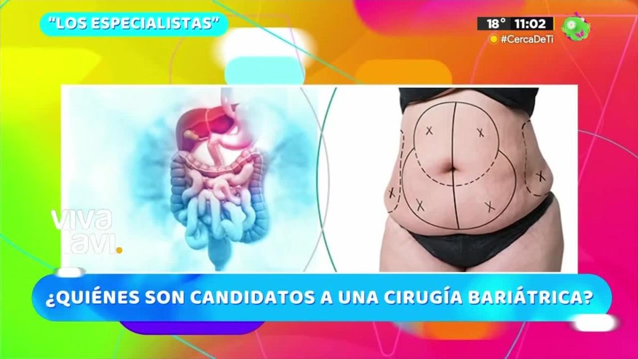 ¿Quiénes son los mejores candidatos para una cirugía bariátrica?