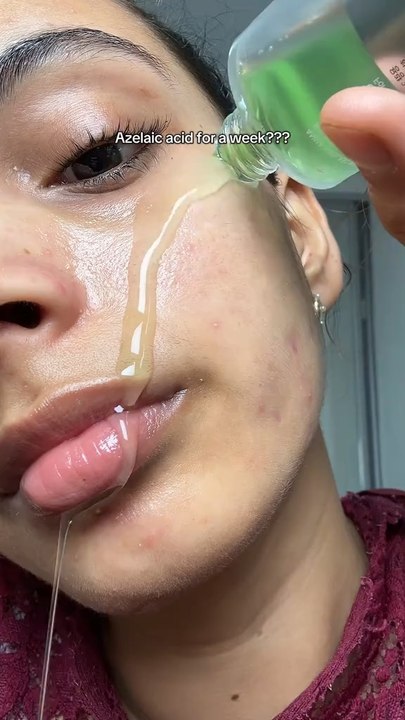 ✨ Anua Azelaic Acid SerumUn sérum apaisant à 10% d’acide azélaïque qui aide à réduire les boutons, les rougeurs et unifier le teint tout en hydratant la peau.💧 Apaise & hydrate✨ Anti-acné & anti-taches🌿 Idéal peau sensible➡️ Peau plus nette