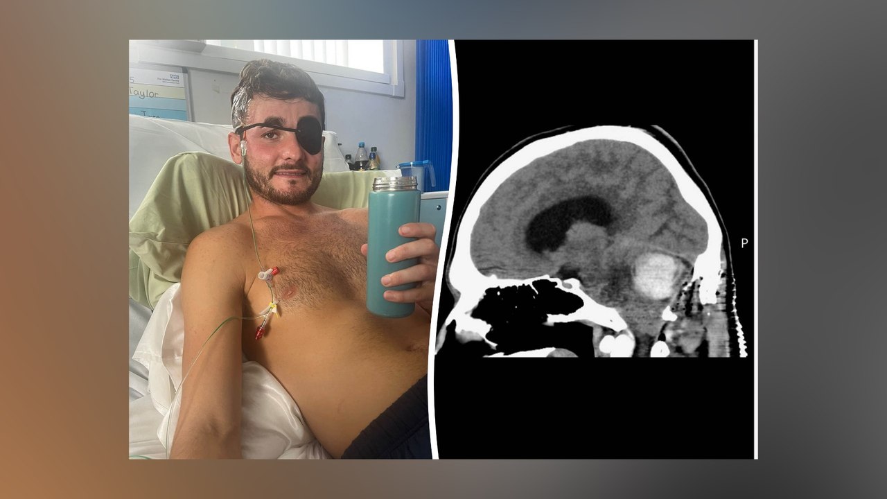 Warrington dad diagnosed with rare brain tumour after years of symptoms
