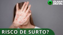 O que o Brasil precisa fazer para se manter livre do sarampo?