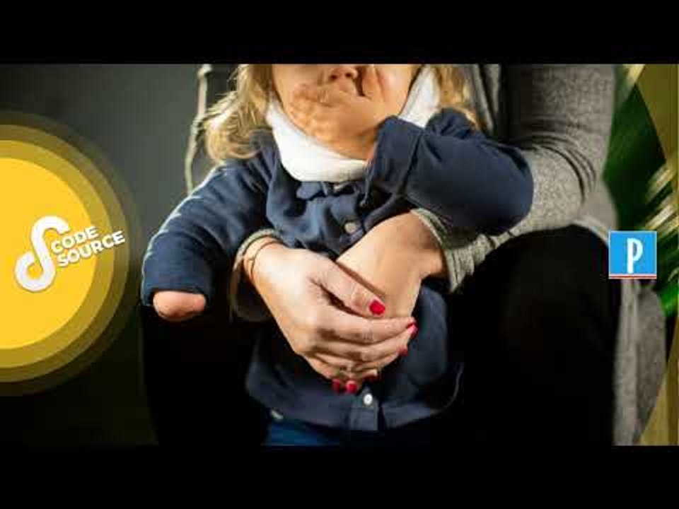 [PODCAST] Bébés nés sans bras : où en est le combat des familles pour la vérité ?