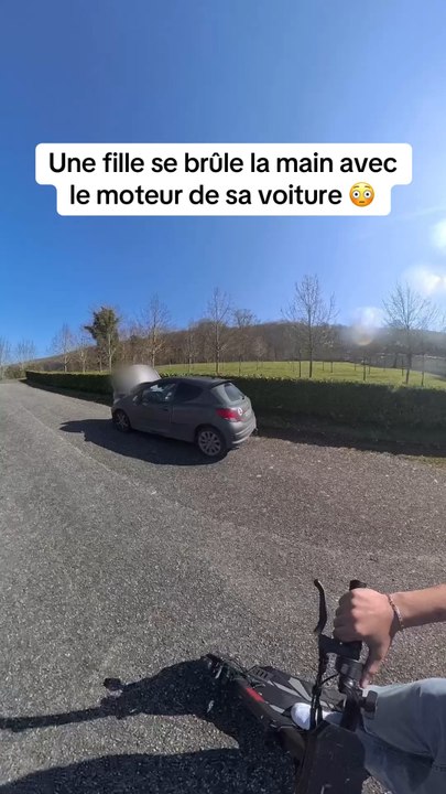 Une fille se brûle la main avec le moteur de sa voiture😳!