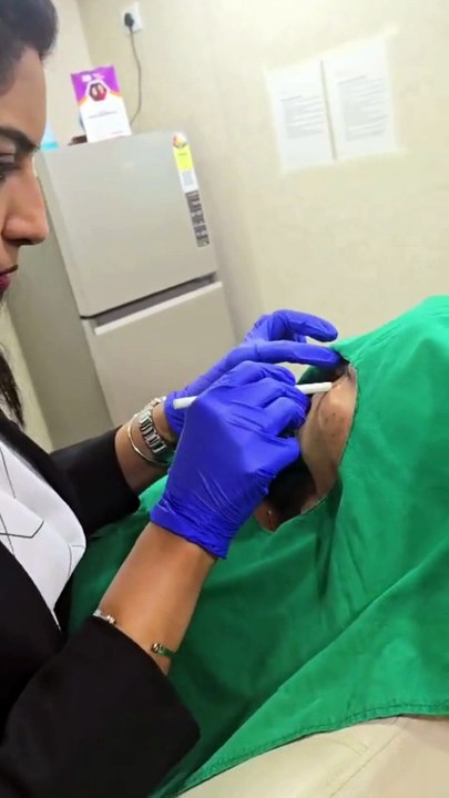 PDRN (Polydeoxyribonucleotide) treatment in Sarjapur Road - SK Truderma
