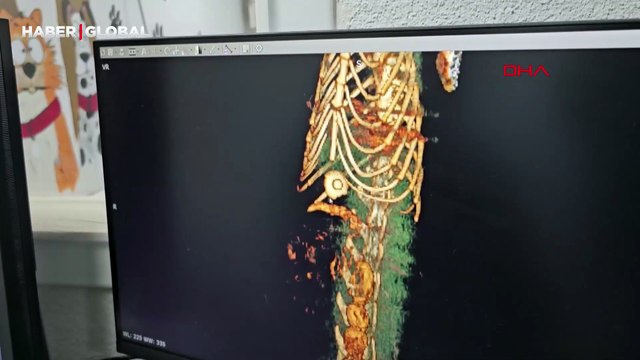 Kedinin midesinden çıktı! Tam 4 yıl sonra fark edildi