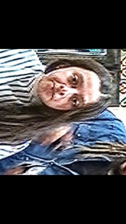 Losing the Hair