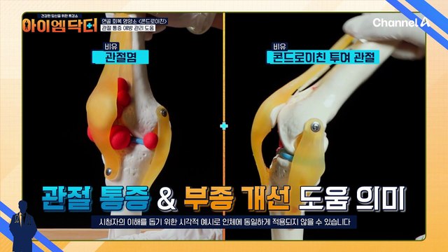 콘드로이친으로 손 관절 통증까지 예방한다?! 전신 관절 걱정 없애주는 효자템 인정!