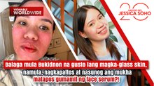 Dalaga, nagkapaltos at nasunog ang mukha matapos gumamit ng face serum?! | Kapuso Mo, Jessica Soho