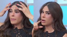 Galilea Montijo explica que le sucedió en el rostro