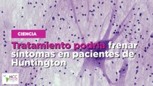 Tratamiento podría frenar síntomas en pacientes de Huntington