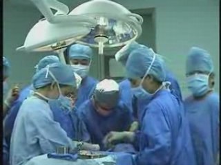 Elephant Man Homme éléphant