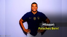 Kylian Mbappé: Real Madrid Ärzte untersuchen falsches Bein? | Medizin-Fiasko