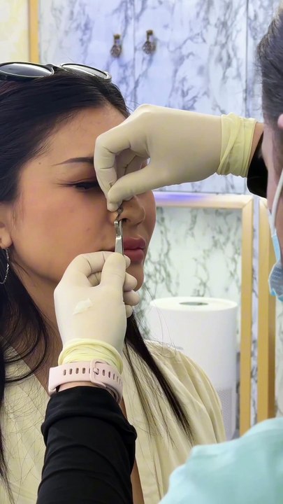 Nose Piercing: Before vs. After (The Glow Up Is Real) #nosepiercing #septumpiercing #earpiercing