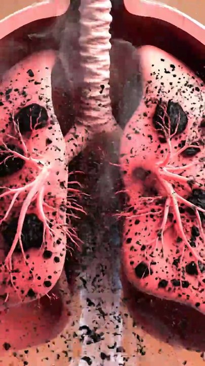 What Happens When You Stop Smoking 3D Animation