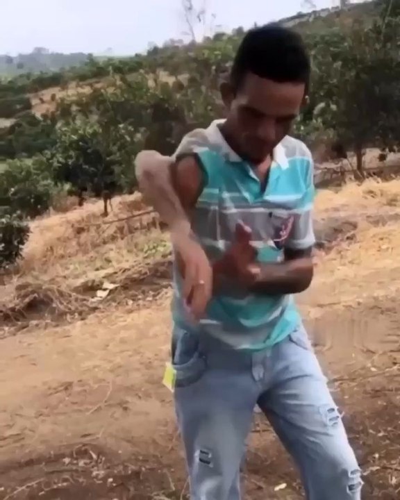 j ai mal au bras 😱😱je ne sais pas vous mais je souffre pour lui ....