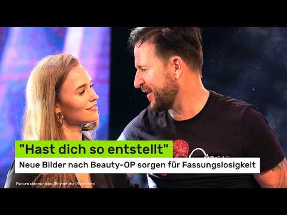 Laura Müller: 'Hast dich so entstellt' - neue Bilder nach Beauty-OP sorgen für Fassungslosigkeit