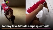 Cão queimado com líquido mostra evolução e aparece brincando: 'Melhorando a cada dia'