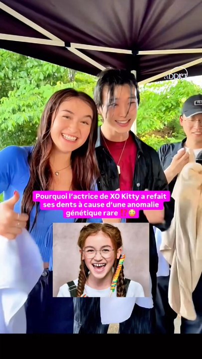 ⁉️ Pourquoi Anna Cathcart a décidé de refaire ses dents alors que l’anomalie génétique rare dont elle souffrait lui donnait un charme unique ? 🥺