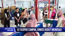 61 Suspek Campak di Kota Malang, Dinkes Kebut Imunisasi