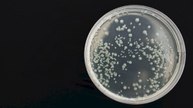Bacteria Can Change Shape to Survive—A Hidden Adaptation Uncovered