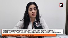 Así se utiliza la placenta en casos extremos de quemaduras infantiles