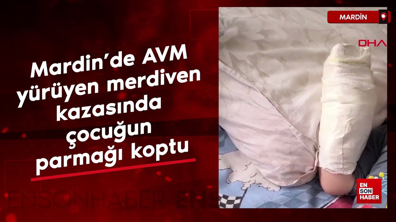 Mardin’de AVM yürüyen merdiven kazasında çocuğun parmağı koptu