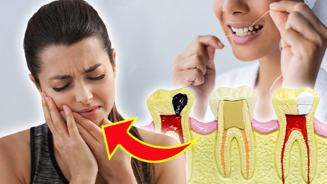 Pulpitis Treatment At Home: दांत की नसों में दर्द हो तो क्या करें,कारण और इलाज | Dant Ki Nas Me Dard