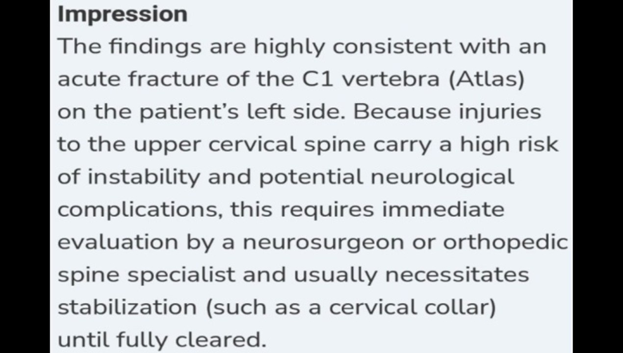 New Analysis Confirms Broken Bone In My '19 CT UAB / Birmingham Radiological Group Tried To Coverup