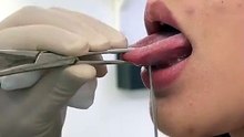From Nervous to Edgy: My Tongue Piercing Journey #tonguepiercing #lippiercing #industrialpiercing