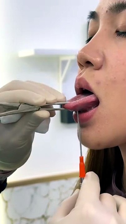 From Nervous to Edgy: My Tongue Piercing Journey #tonguepiercing #lippiercing #industrialpiercing