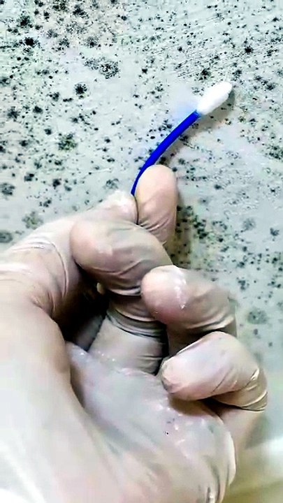 Invisible Danger: Mold in Your Home | Green Planet Restoration